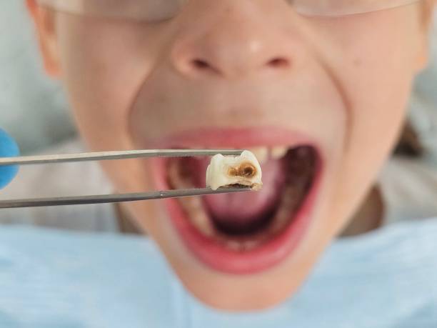 Best Same-Day Emergency Dental Services in Orlinda, TN